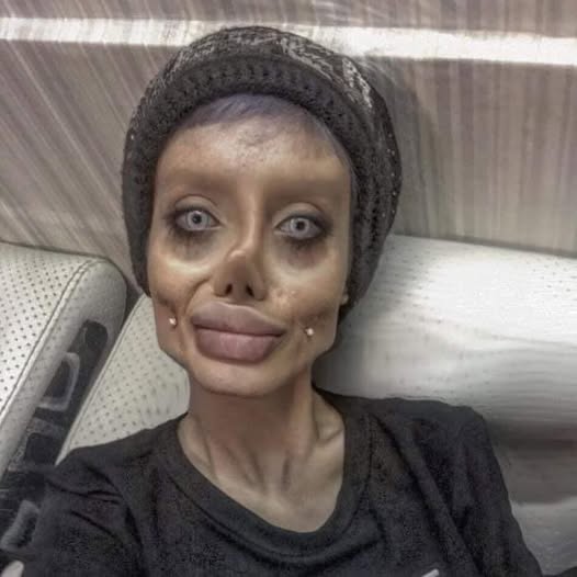 Angelina Jolie’s ‘Zombie Lookalike’ Emerges from Jail After Deception