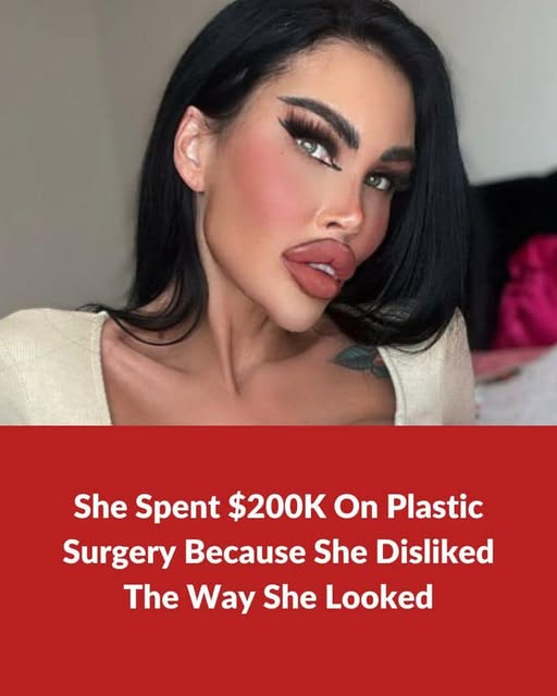 Despite Doctors’ Warnings, Plastic Surgery Enthusiast Pursues Unattainable Perfection