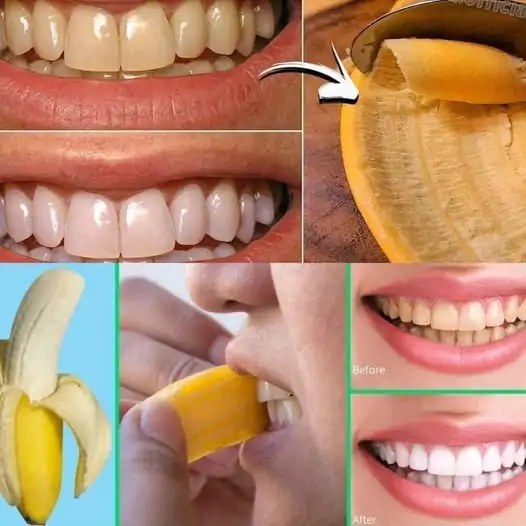 Secret That Dentists Don’t Want You to Know